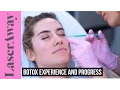 Trying Botox For The First Time LaserAway