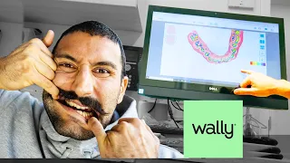 I Tried the CHEAPEST Dentist in NYC Wally Health