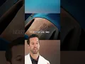 ER Doctor REACTS to Pectus Excavatum