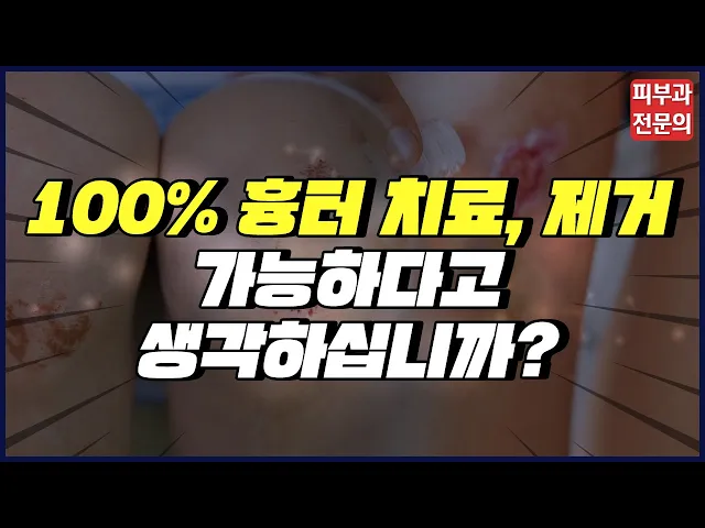 흉터치료 100%? 제거 가능하다고 하는 병원들 믿어도 될까? | 색소침착, 켈로이드흉터, 패인흉터 | 타임리스피부과의원