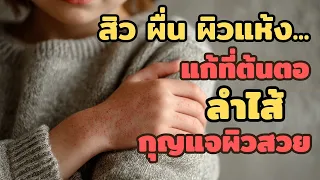 ทำไมการดูแลลำไส้จึงสำคัญต่อสุขภาพผิว