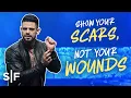 Download Lagu Show Your Scars, Not Your Wounds | Steven Furtick