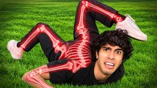 I Broke 9,243,543 Bones..