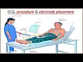 Electrocardiogram CPT code - simplify medical coding