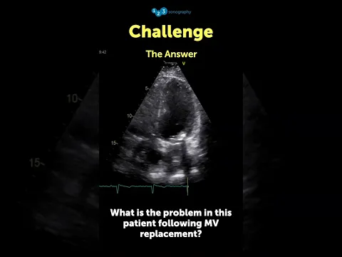 Answer!