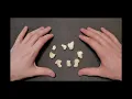 Identification of Bony Landmarks - Carpals Hand