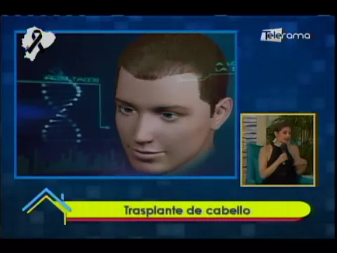 Transplante de cabello