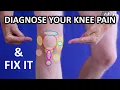 Download Lagu Every Knee Pain EXPLAINED in 11 Minutes... \u0026 Their Fixes!