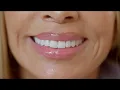 Faye Resnick Patient Story - Full Mouth Makeover with Porcelain Veneers