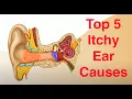 Top 5 Causes of Itchy Ears and Treatment Too