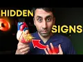Download Lagu Doctor Explains Heart Attack Symptoms: 7 Warning Signs You Should NEVER Ignore! 🫀⚠️