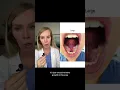 Do you have bumps under the tongue This may explain