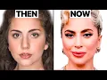 Lady Gaga NEW FACE Plastic Surgery Analysis