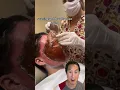 Download Lagu Watch Her Skin Get Lifted Off Her Face! #phenol #chemicalpeel