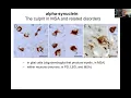 2021 Neuroscience Symposium | Multiple Systems Atrophy