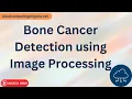 Bone Cancer Detection using Image Processing