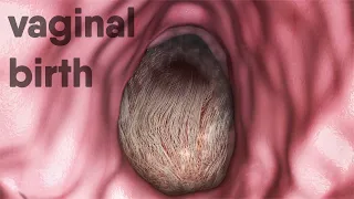 Download vaginal birth-natural childbirth MP3