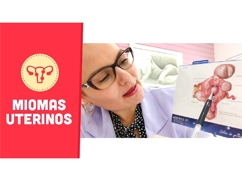 Download MP3 Miomas Uterinos