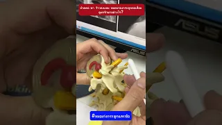  ทำไมคนที่มีอาการปวดคอ ปวดศีรษะ และชาลงแขน จึงต้องระวังการนอนคว่ำ 