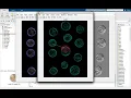 Coin Detection and Counting by Matlab - Computer Vision