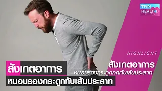 อาการปวดหลังร้าวลงขาเกิดจากสาเหตุอะไรบ้าง