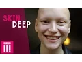 Download Lagu Loving Life Without Hair | Joelle | Skin Deep