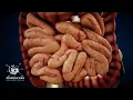small intestine 3d medical animation