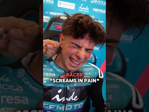 This Looks So Painful 🤯