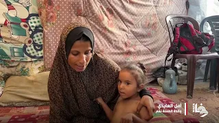 نغم قد تفقد حياتها بسبب التجويع في غزة