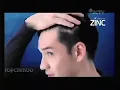 Iklan Zinc Clean Active (2018) @ RCTI, SCTV, Indosiar, ANTV, tvOne \u0026 Trans TV