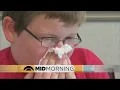 Advice From Pediatrician For Seasonal Allergies