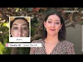 Real customers Real stories Real results Musely Dark Spot Remover Reviews