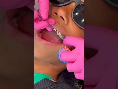 Rainbow Braces 🌈