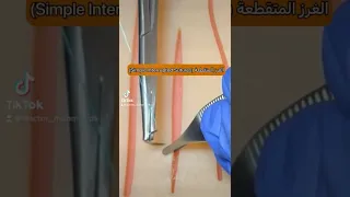                                   الغرز المتقطعة دندنها