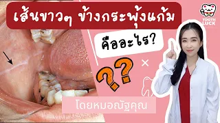  เส้นขาวข้างกระพุ้งแก้มที่เห็นหลังตื่นนอนเกิดจากสาเหตุอะไร และควรทำอย่างไรบ้าง 