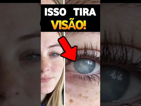 Grace Jamison  perdeu a visão por tomar banho de piscina usando lentes de contato #youtubeshorts