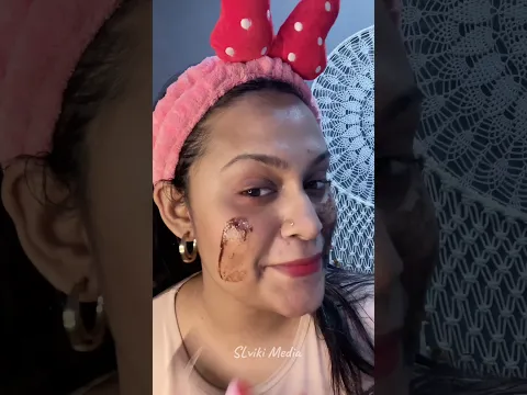 Blackheads removal Mask බ්ලැක්හෙඩ්ස් වයිට්හෙඩ්ස් ඉවත් කරගන්න #blackheads #skincare
