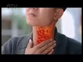 Iklan Adem Sari Chingku - Macam Macam Panas Dalam 15''