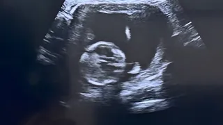 Conociendo a nuestro bebé por primera vez 🤍🍼