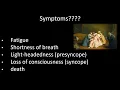 How to Read an ECG Sinoatrial Node Bradycardias Sinus Pauses or Arrests Tachy-Brady Syndrome