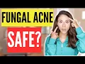 FUNGAL ACNE SAFE SKINCARE EXPLAINED Dermatologist