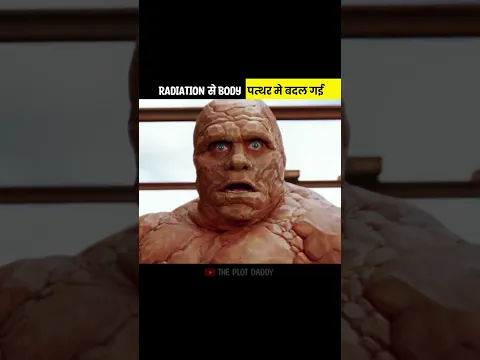 His Body Became Stone After Radiation ☢️#shorts