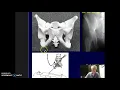 Image evaluation Judet views