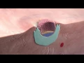 Download Lagu Implantation of the blastocyst