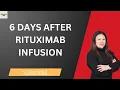 6 Days After Rituximab Infusion - My Experience Recovery