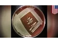Elizabethkingia infections mysterious bacteria claims 20 lives in three states in the US - TomoNews