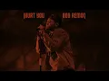 The Weeknd - Hurt You (80s Remix)
