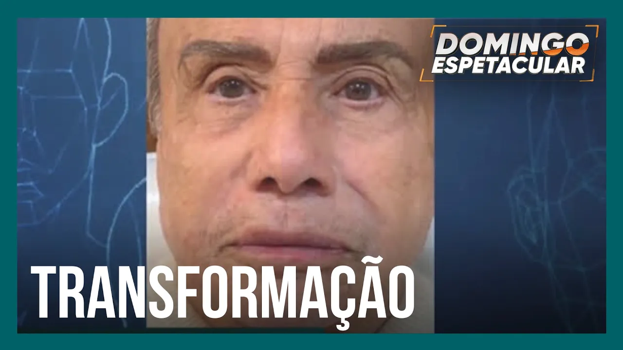 Stênio Garcia faz harmonização facial aos 91 anos de idade