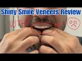 Shiny Smile Veneers Review - Are Shiny Smile Veneers The Best Snap On Veneers