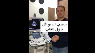سحب السوائل حول القلب مع الدكتور عمرو رشيد دندنها